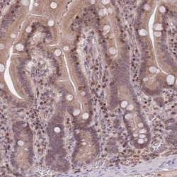 SLC35F5 Antibody, Novus Biologicals 0.1mL; Unlabeled:Antibodies, Polyclonal